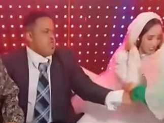 متلازمة داون