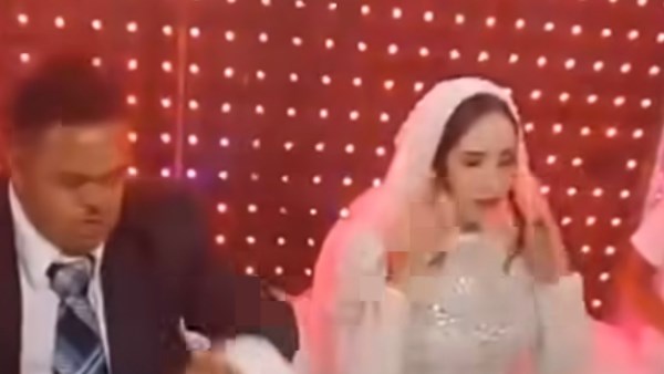 متلازمة داون